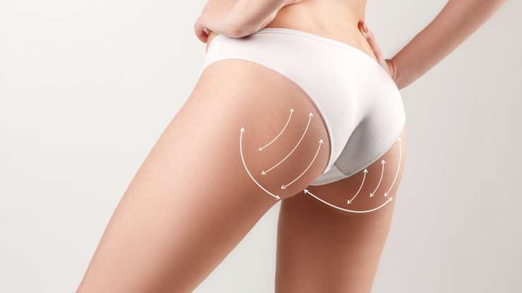 BODY RECOVERY SURGERIES AFTER WEIGHT LOSS
